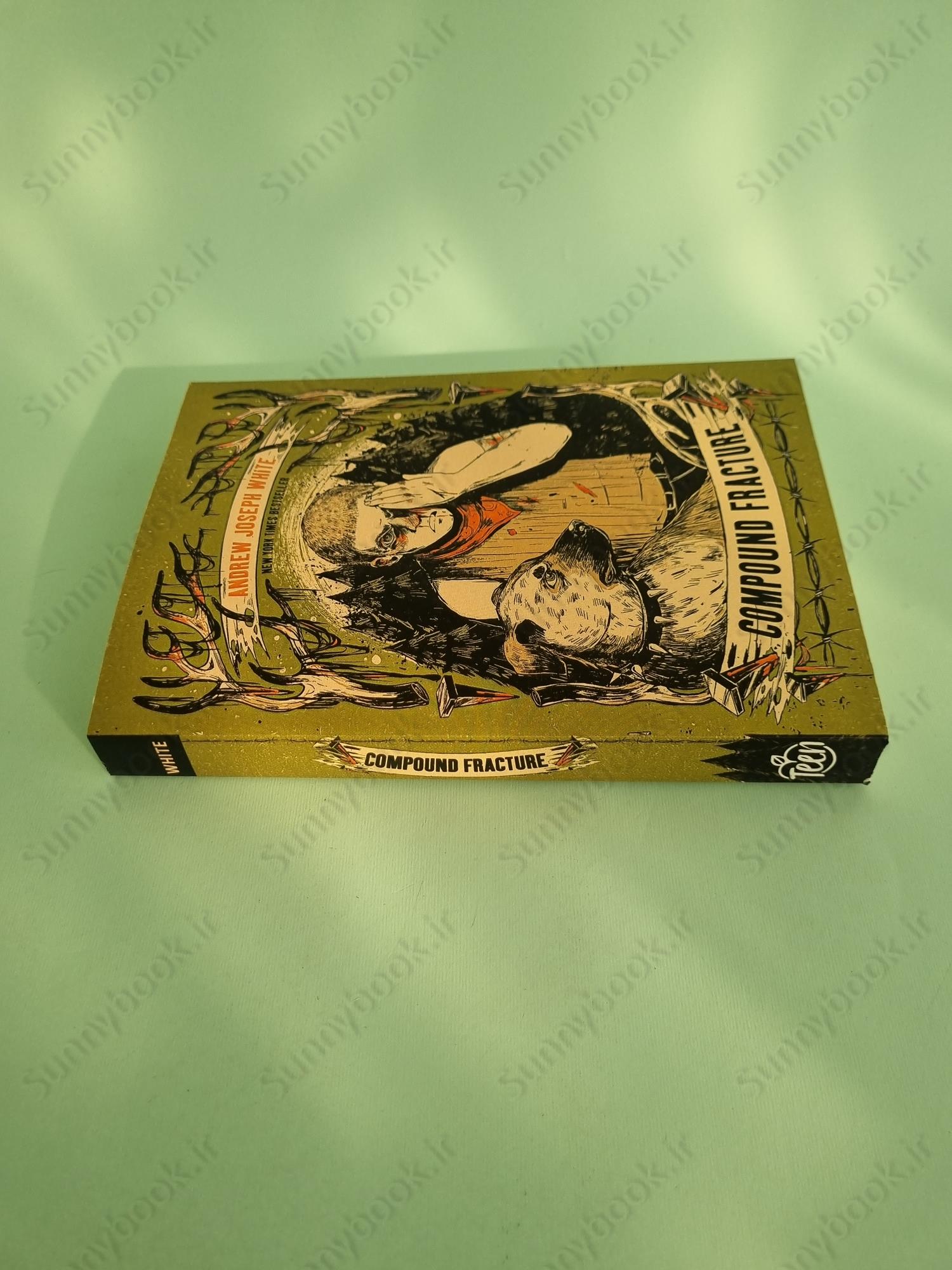 Compound Fracture main 1 4